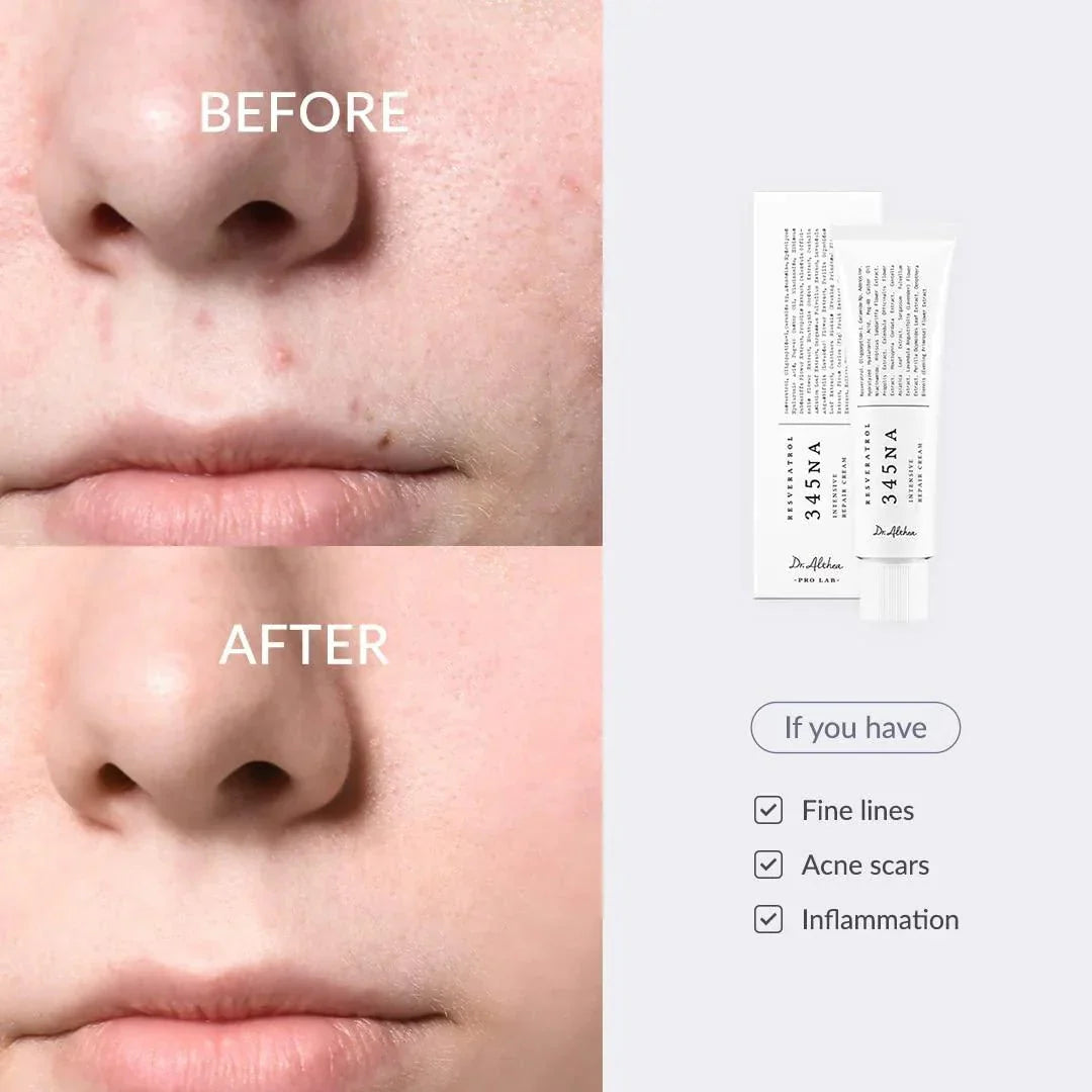 Dr Althea 345 Relief Cream 50ml - Made in Korea - Buy 1 Get 1 Free