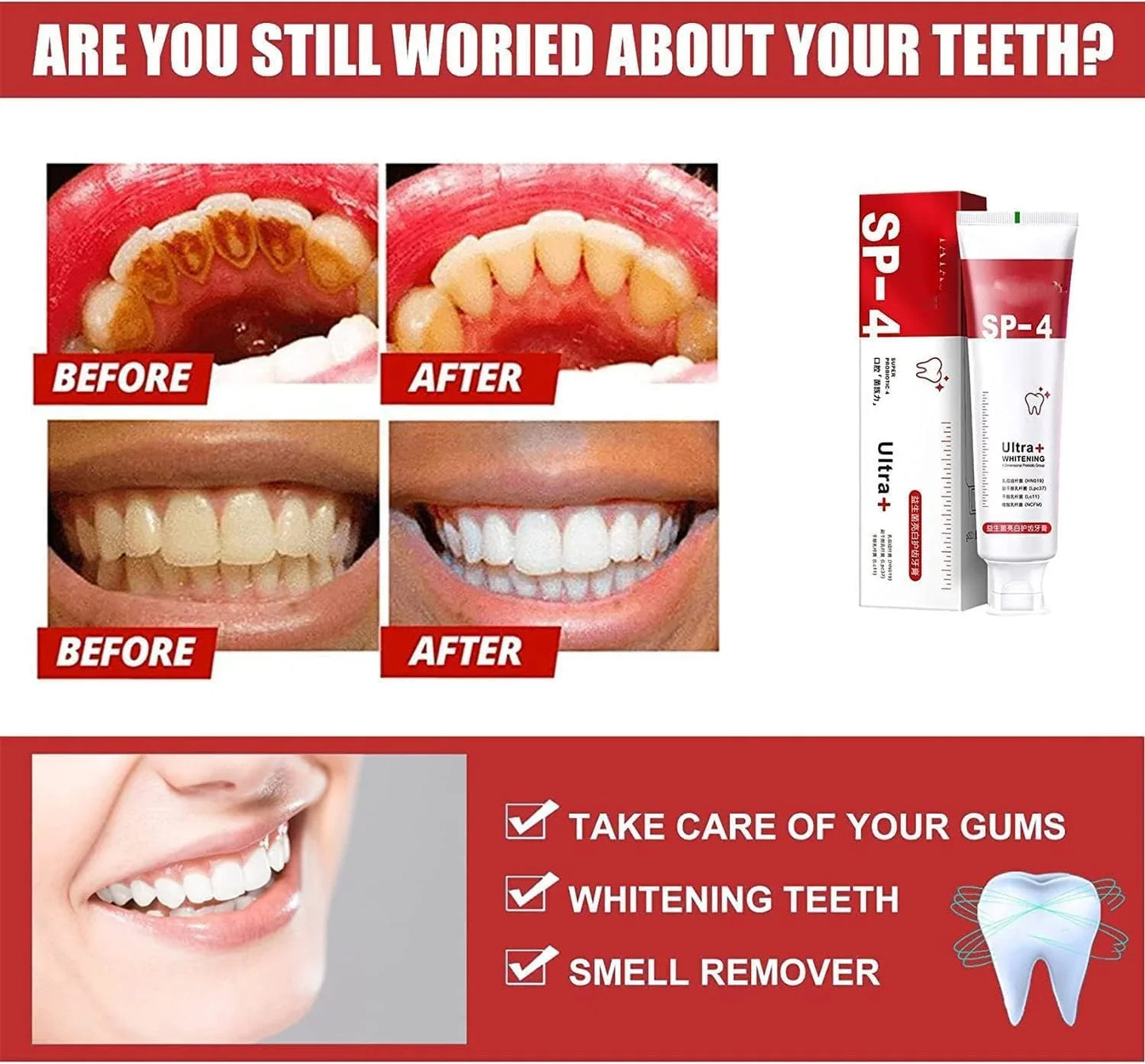 Yayashi SP4 Probiotic Toothpaste [ Buy 1 Get 1 Free ]
