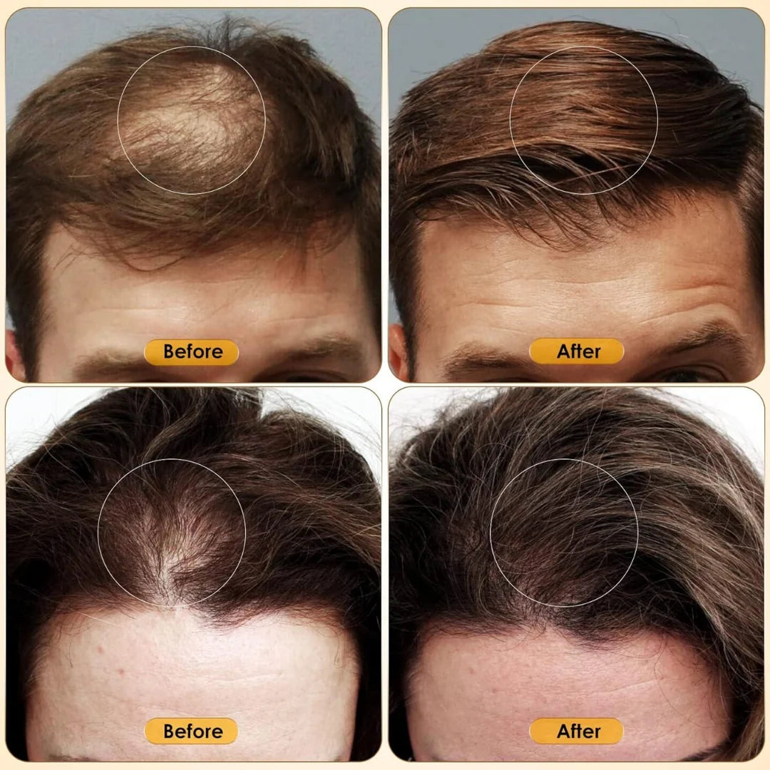 Proskire Hair Growth Serum [Buy 1 Get 1 free]