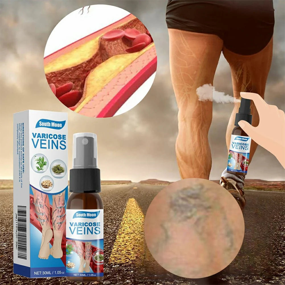 Varicose Veins Treatment Spray [ Buy 1 get 1 Free ]