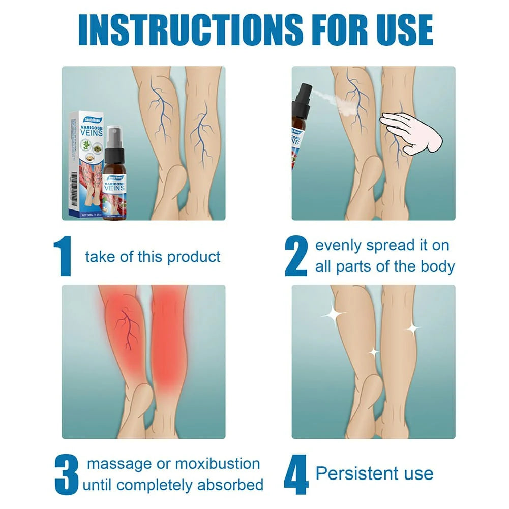 Varicose Veins Treatment Spray [ Buy 1 get 1 Free ]