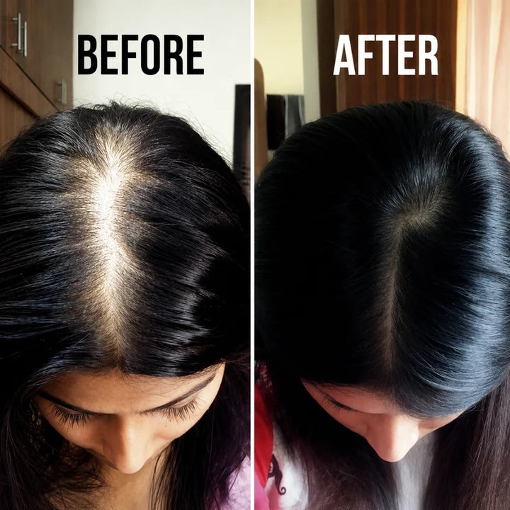 Proskire Hair Growth Serum [Buy 1 Get 1 free]