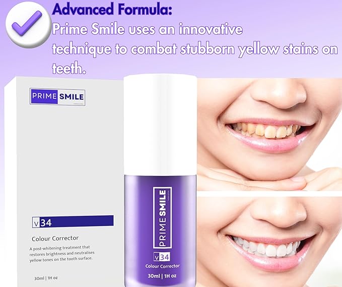 HiSmile V34 Advanced Teeth Whitening Serum Quick Traders 
