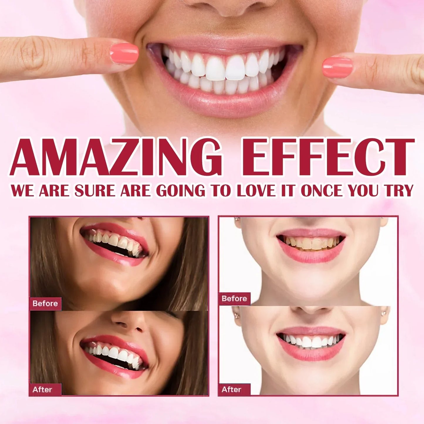 Yayashi SP4 Probiotic Toothpaste [ Buy 1 Get 1 Free ]